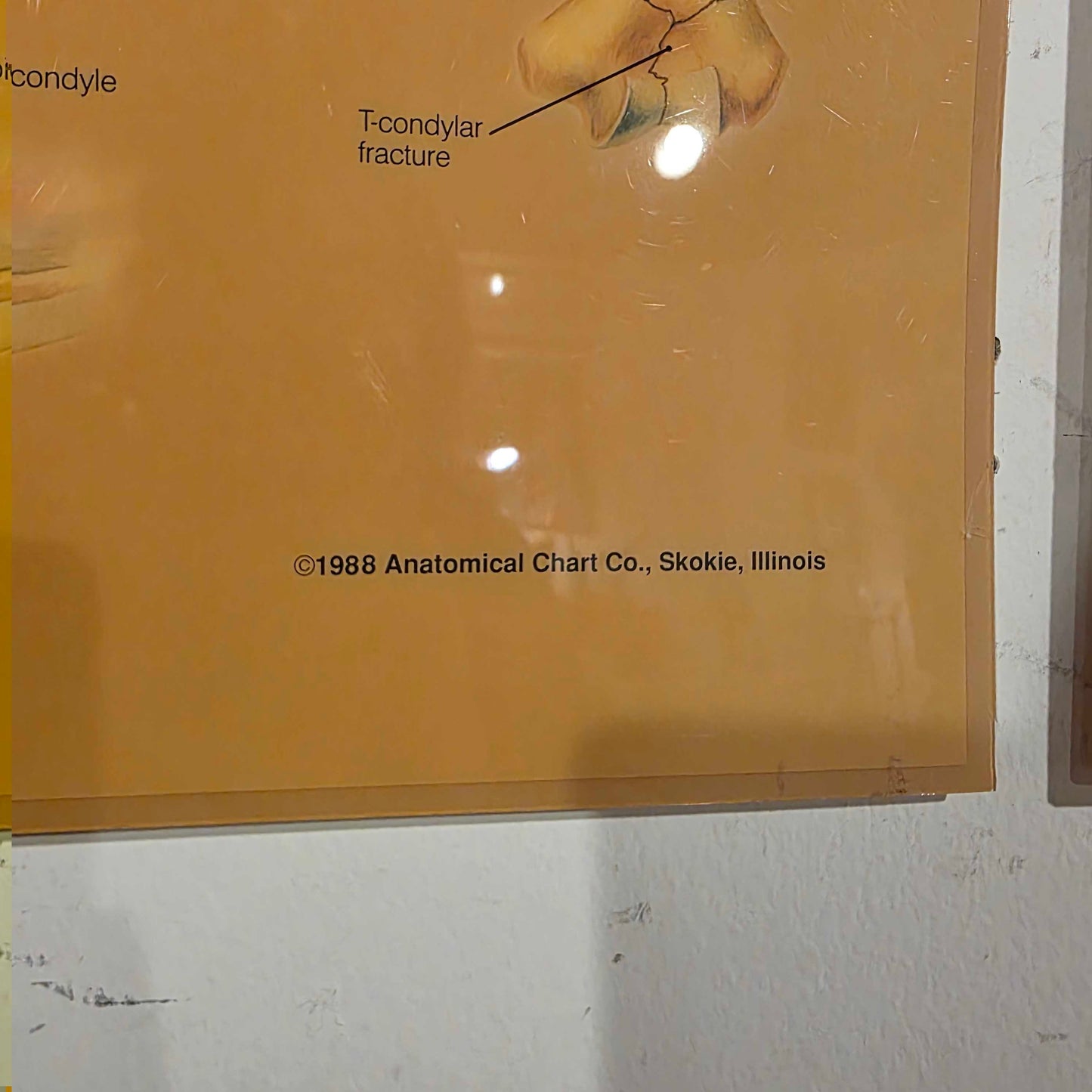 Shoulder Anatomy Chart