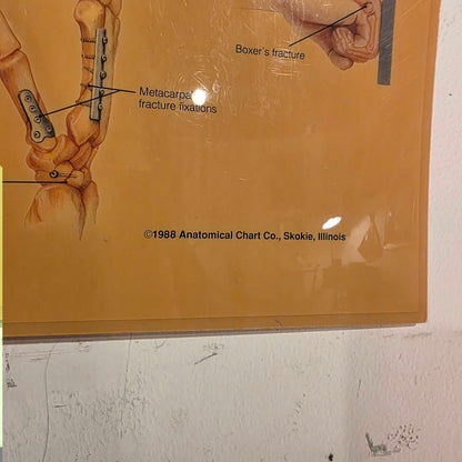 Hand and Wrist Anatomy Chart