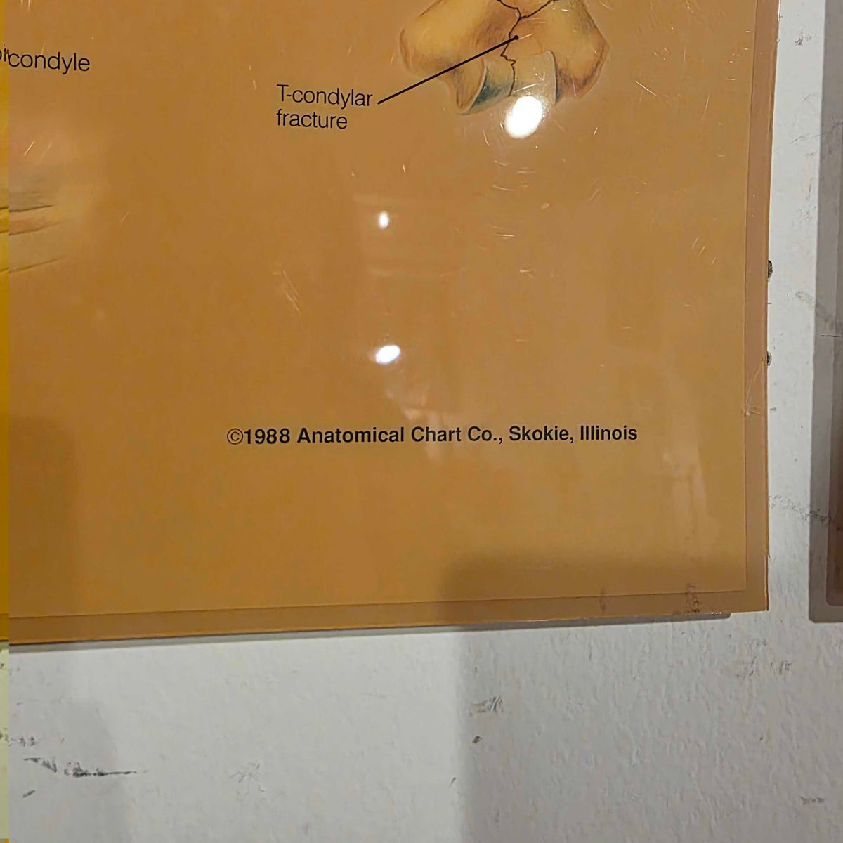 Shoulder Anatomy Chart ART